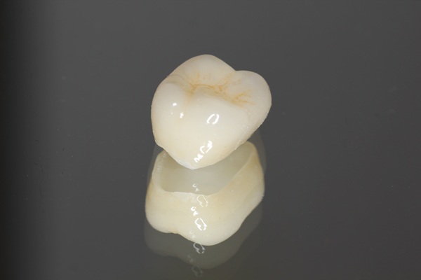 Dental Crown Materials: How To Make The Right Choice For Your Smile